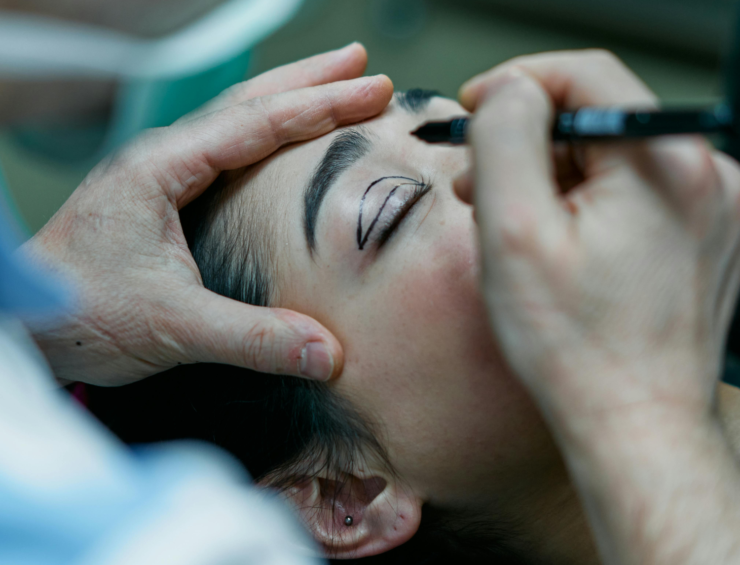 Plastická chirurgie